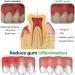 3 PCs Dentizen Gum Regrowth Drops | Natural Oral Care Mouthwash for Healthy Gums - Buy Online on GoSupps.com