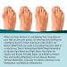 Bunion Relief Fit Patch - Pain Relieving Bunion Corrector Pads (1 Box) - Buy Online on GoSupps.com