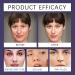 Bakuchiol Serum With Hyaluronic Acid And Peptide Retinol Alternative Face Serum For Face And Neck Korean Bakuchiol Concentrate Wrinkle Reduction Skin Firming (3) - Buy Online on GoSupps.com
