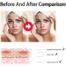 Azelaic Acid Suspension 10% Face Serum Azelaic Acid Serum Cream with Niacinamide & Vitamin C Anti Acne Cream Face Serum for Women Hydrating Serums Skincare to Reduces Blackheads Anti Aging Serum - Buy Online on GoSupps.com