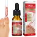 Ingrown Toenail Treatment, Ingrown Toenail Pain Relief, Natural Ingrown Toenail Correction Treatment, Easy Trimming Toenail Softening Drops, 30ml 30ml (1 bottle)