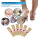 Callus and Toe Corn Remover for Fast Relief and Protection - 42 Pads - Buy Online on GoSupps.com