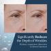 Delfogo Rx Deep Wrinkle Filler Serum | Best Anti-Aging Treatment for Fine Lines & Wrinkles - Youthful Skin Solutions - Buy Online on GoSupps.com