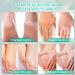Urea 40 Foot Cream with Salicylic Acid - Best Callus Remover for Dry Cracked Heels - Buy Online on GoSupps.com