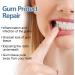 Qylen Gum Repair Gel Tooth Repair Gel Gum Protection Therapy Gel Gum Therapy Gel for Reset Gums Essence Pen - Buy Online on GoSupps.com