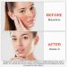 GO MAY Hydration Facial Toner FT02 - Soothing & Calming Daily Face Toner | 5 FL.OZ | International Shipping Available - Buy Online on GoSupps.com