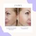 Aha Pha Bha 32% Serum | Reduce Fine Lines Wrinkles & Dead Skin | Exfoliate for Brighter Youthful Skin - Shop Internationally - Buy Online on GoSupps.com