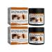 Strong whitening cream for dark knees and elbows The most popular whitening cream in 2023 Dark spot correcting cream Whitening cream for the intimate area Moisturizing the skin