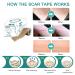 Silicone Scar Tape Roll - Easy-Tear Gel Tape for Surgery Scars - 1.6 x 120 Inch - Medical Grade Silicone Sheets - Wound Dressing for Scar Management - Buy Online on GoSupps.com