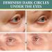 Jasmine Ointment for Dark Circles & Wrinkles - 2 Piece Eye Cream Set | Remove Dark Rings & Revitalize Eyes - Buy Online on GoSupps.com