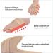 Bunion Splint for Hallux Valgus Corrector - Ergonomic, Washable, Fixation for Home & Clinic Foot Care - Men & Women - Buy Online on GoSupps.com