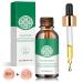 30ml toenails treatment fast -acting nail treatment nail care for toenails protection & strengthening of brittle nails nail care without filing