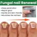 S rum pour ongles - 30 ml x 2 - Huile nourrissante pour les ongles et les cuticules - Traitement des ongles incarn s - Pour ongles craquel s rugueux cassants et fendus - Buy Online on GoSupps.com
