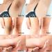 Skin Bleaching Cream for Body | Dark Spot Remover & Skin Lightening for Intimate Areas Underarms Knees Elbows & More - Buy Online on GoSupps.com