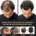 Mane Root Activator Shampoo Natural Herbal Hair Growth Shampoo Hair Loss Shampoo Promotes Thicker Faster Growing Hair For Men & Women - Buy Online on GoSupps.com