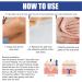 Silicone Breast Scar Sheets for Scar Reduction and Elasticity Restoration - Buy Online on GoSupps.com
