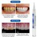 Professional Teeth Whitening Kit - 2x Teeth Whitening Abbey Essence for Gentle & Fast Results - Buy Online on GoSupps.com