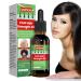 Essential oil for natural hair density 30 ml natural hair growth oil wild hair growth oil essential oil for the hair density essential oil for the back of the hair Aibyks