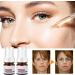 Aobenz Serum | Aobenz Whitening and Freckle Removing Essence | Aobenz Anti-Spot Serum Aobenz Spot Remover Serum Aobenz Dark Spot Correcting Serum Brightening and Removing Freckles (2Pcs) - Buy Online on GoSupps.com