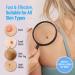 Zacurate Skin Tag Remover & Wart Mole Verruca Treatment Lotion - Fast-Acting Blue Formula - 30ML (Pack of 1) - Buy Online on GoSupps.com