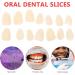 EXCEART Teeth Veneer x100 - Temporary Resin Tooth Fillings for Tooth Repair - Buy Online on GoSupps.com
