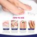 Extra Strength Toenail Fungus Treatment - Antifungal Solution for Nail & Athlete's Foot Care - Buy Online on GoSupps.com