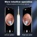 1080P Ear Wax Removal Tool with Camera Kit for iOS Android, 6 Ear Pick Ear Clean Kit - White - Buy Online on GoSupps.com