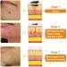 BBOJI 7-Day Multi-Effect All-in-One Skincare Cream 2025 New Professional Bee Venom Cream BOJI Bee Venom Skin Treatment Cream Repair moisturize and lift 3 in 1 for All Skin Types (1 Bottle) - Buy Online on GoSupps.com