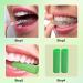 Uilyniu 20 Aligner Chewies - Comfortable Tablets for Aligner Sitzer & Chompers | Green Chewies for Perfect Fit - Buy Online on GoSupps.com