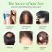Rice Essential Oil for Hair Growth - 100% Pure Natural Serum for Thin, Damaged Hair - Men & Women - All Hair Types - Buy Online on GoSupps.com