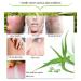 Organic Aloe Vera Gel 300ml - Soothing Moisturizer for Face, Body & Hair | Sunburn & Scar Repair - Buy Online on GoSupps.com