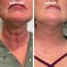 Fubst Skin Firming Rejuvenating Serums Night Skin Firming Cream Lifting And Firming Refreshing And Non-Sticky Fubst Hyaluronic Acid For All Skin Types - Buy Online on GoSupps.com