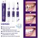 Teeth Whitening & Stain Removal Pencil | Gentle Toothpaste for Cavity Repair & Fresh Breath | Shop Internationally - Buy Online on GoSupps.com