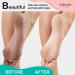 Karlash 2-Sided Nickel Foot File - Mint Callus Trimmer and Remover (1 Pack) - Buy Online on GoSupps.com