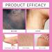 Kojic Underarms Brightening Serum Kojic Whitening Brightening Moisturizing And Revitalizing Skin Mild Ingredients Lightening Serum for intimate parts armpits and intimate parts 30ml (2pc) - Buy Online on GoSupps.com
