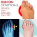MisFun Bunion Correction Sandals - Arch Support & Comfort - Silver 8.5 - Buy Online on GoSupps.com