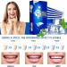 Elunara Bandes de blanchiment des dents blanches 5D bandes blanches de blanchiment des dents bandes blanches efficaces sensibilit r duite sans sensibilit id ales pour les voyages (2) - Buy Online on GoSupps.com