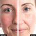 Avonn Anew Protinol Power Serum - Fight 7 Signs of Aging Smooth Skin Minimize Pores & Lines - Fast Results in 7 Days | International Shipping - Buy Online on GoSupps.com