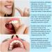 Myospots - Effective Tongue Training Tablets in Banana Flavor - 100 Count for Better Breathing & Health - Buy Online on GoSupps.com