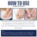 German Ingrown Toenail Drop: Paronychia Oil for Toenail Care - Nail Repair Solution (1pc) - Buy Online on GoSupps.com