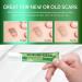 Advanced Keloid Bump Removal Gel - Silicone Scar Treatment for Piercing Surgery Acne & Burns - Fast Healing Formula 30g - Buy Online on GoSupps.com