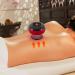 Smart Dynamic Cupping Therapy Set - Enhance Circulation & Relaxation | Traditional Chinese Massage - Buy Online on GoSupps.com