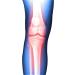 Soles Hinged Knee ROM Orthosis (SLS311S) | International Shipping | Comfortable & Adjustable Knee Support - Buy Online on GoSupps.com