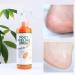 Xebular Immediate Foot Peeling Spray - Quick Dead Skin Removal & Foot Mask for Smooth Feet - Buy Online on GoSupps.com