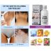 Go Ho 2PCS Dark Spot Remover - Vitamin C Cream for Face Body & More | Effective Blench Lotion & Dark Spots Corrector - Buy Online on GoSupps.com