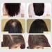 Veganic Natural Hair Growth Oil Veganic Hair Growth Oil For Hair Growth Natural Hair Growth Oil For Dry And Damaged Hair Promotes Growth And Thickness (2pc) - Buy Online on GoSupps.com