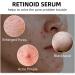 Face Moisturiser Retinoid 2% Emulsion Retinol Serum High Strength for Face Retinol Face Serum Anti Wrinkle Serum Fade Fine Lines Acne Reduced Skin Repair Serum for Women & Men 30ml 1PC Retinoid 2% Emulsion - Buy Online on GoSupps.com