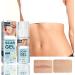2Pcs Stretch Marks Remover 50ml Scar Gel w/ Allantoin & Vitamin E - Hydrating & Renewing for Scars from Burns & Surgery - Buy Online on GoSupps.com