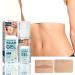 Stretch Mark Gel 2Pcs 50ml with Allantoin & Vitamin E - Hydrating Scar Remover for Scars, Burns & Surgery - Buy Online on GoSupps.com