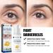 DGUSO Jasmine Cream Against Dark Circles and Saggy Eyelids Active Jasmine Cream Against Tear Bags Jasmine Eye Cream Against Wrinkles Collagen Aloe Vera Extract Eye Cream - Buy Online on GoSupps.com